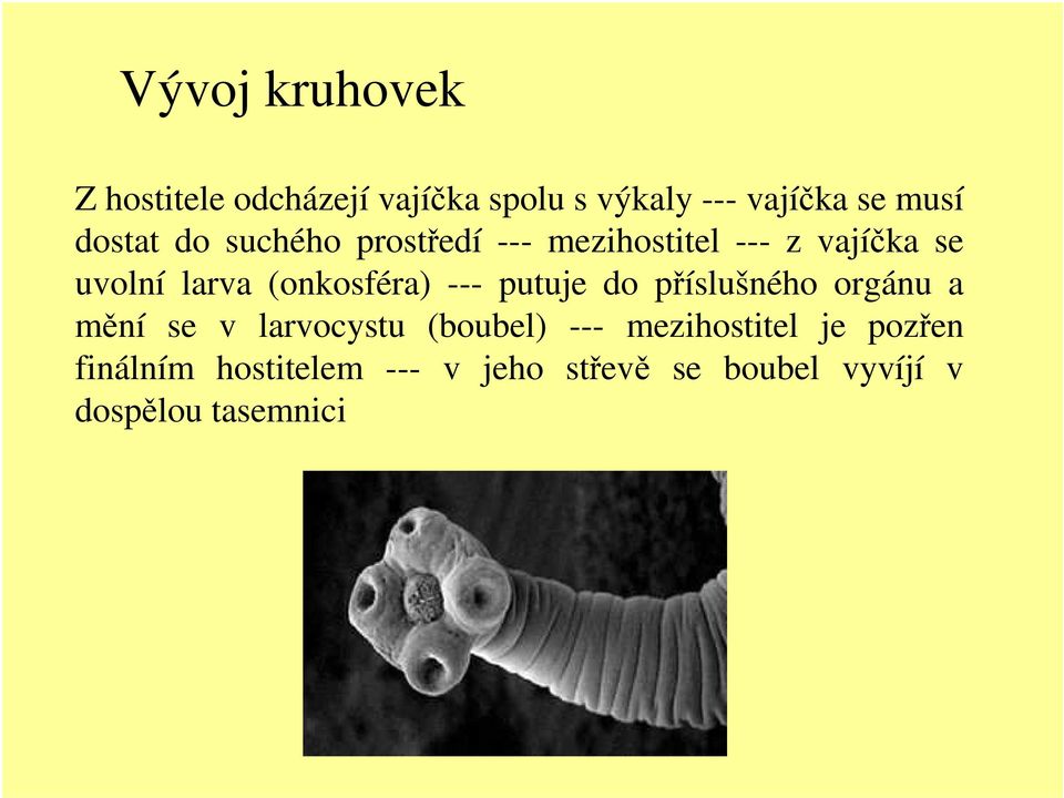 (onkosféra) --- putuje do příslušného orgánu a mění se v larvocystu (boubel) ---