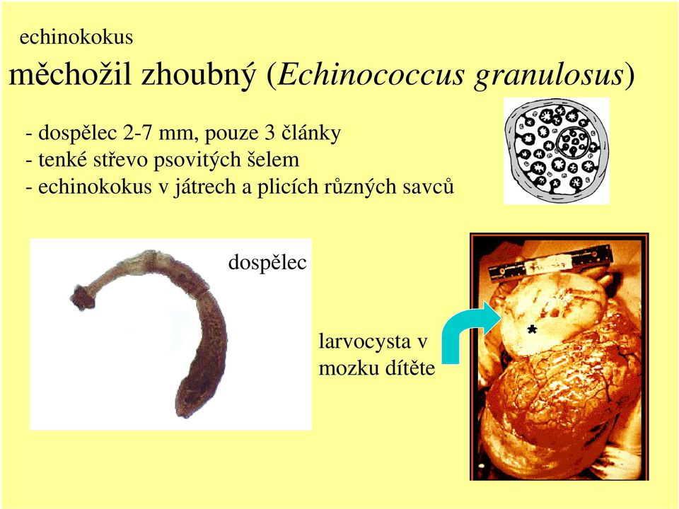 tenké střevo psovitých šelem - echinokokus v