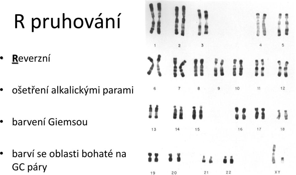 parami barvení Giemsou