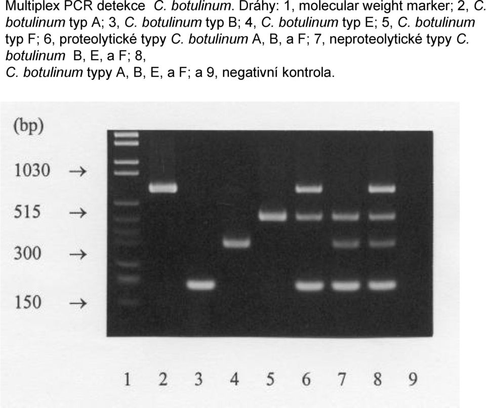 botulinum typ F; 6, proteolytické typy C.