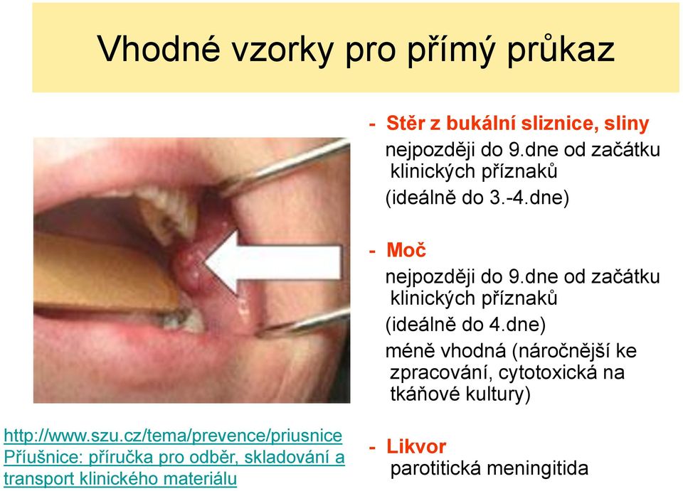 dne od začátku klinických příznaků (ideálně do 4.