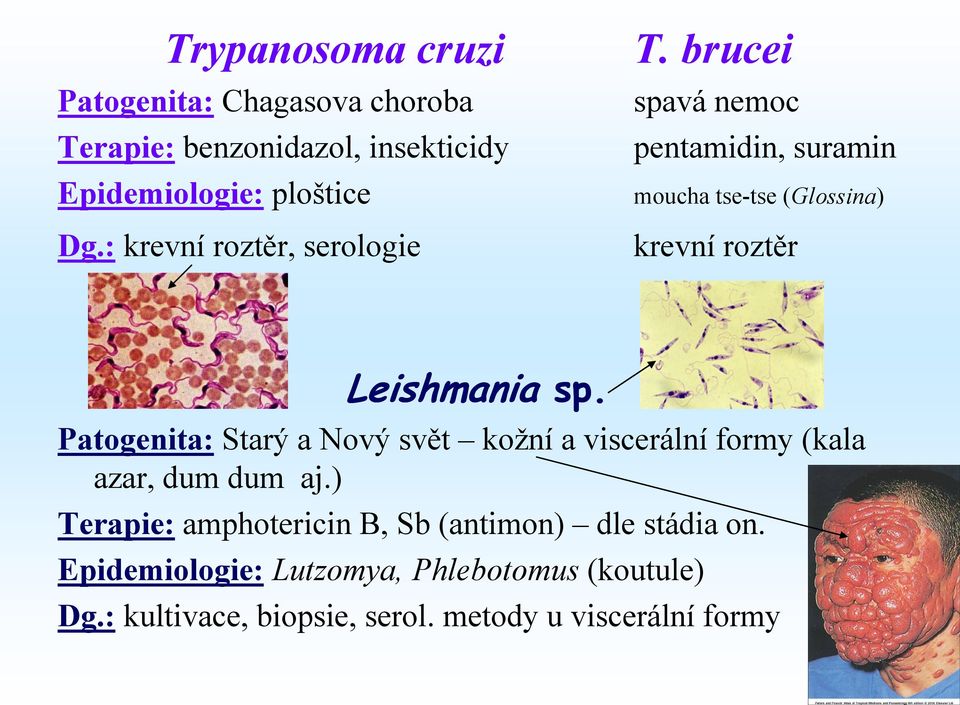 brucei spavá nemoc pentamidin, suramin moucha tse-tse (Glossina) krevní roztěr Leishmania sp.