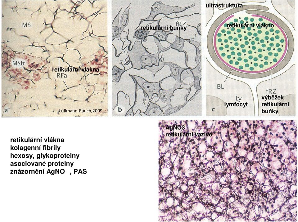 vlákna kolagenní fibrily hexosy, glykoproteiny asociované