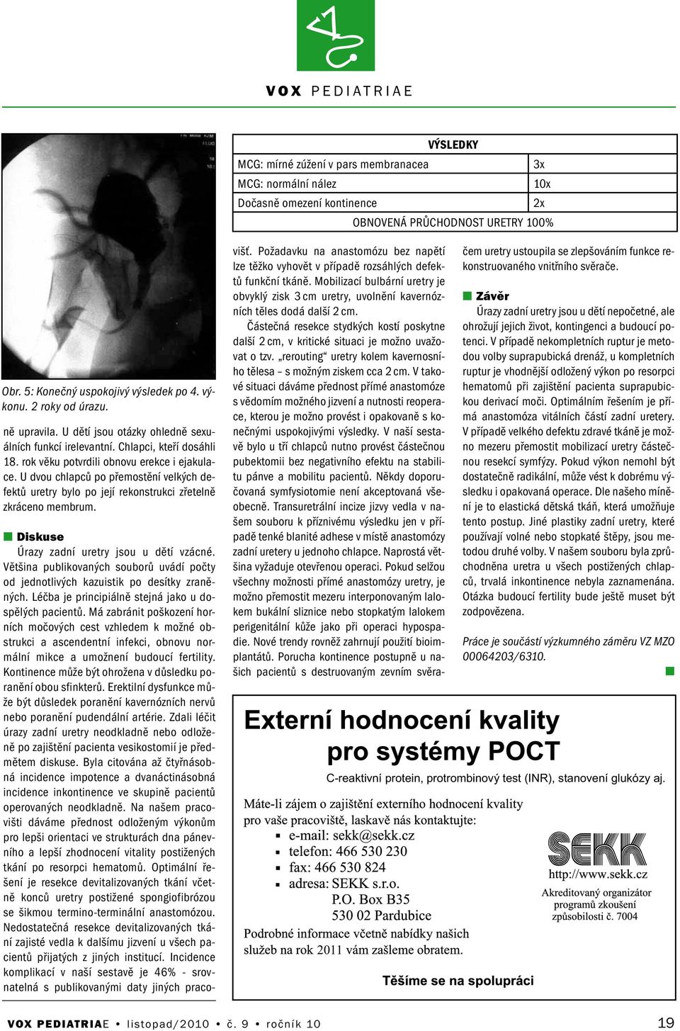 U dvou chlapců po přemostěí velkých defektů uretry bylo po její rekostrukci zřetelě zkráceo membrum. 2011 Diskuse Úrazy zadí uretry jsou u dětí vzácé.