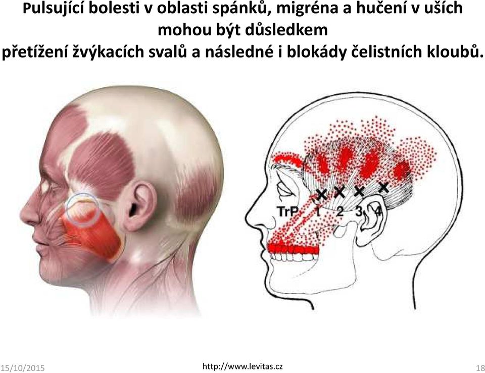 žvýkacích svalů a následné i blokády