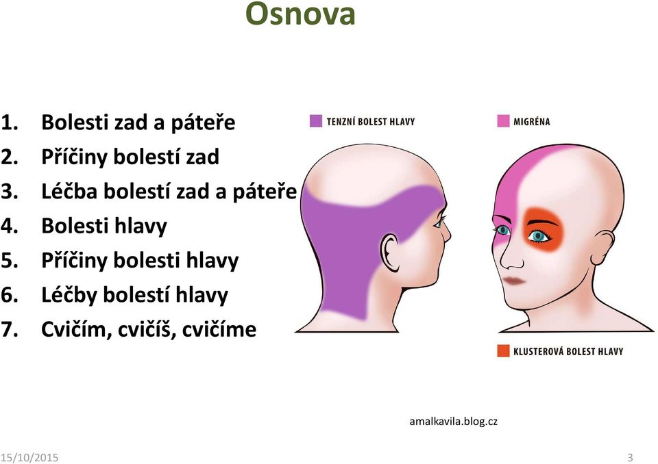 Bolesti hlavy 5. Příčiny bolesti hlavy 6.