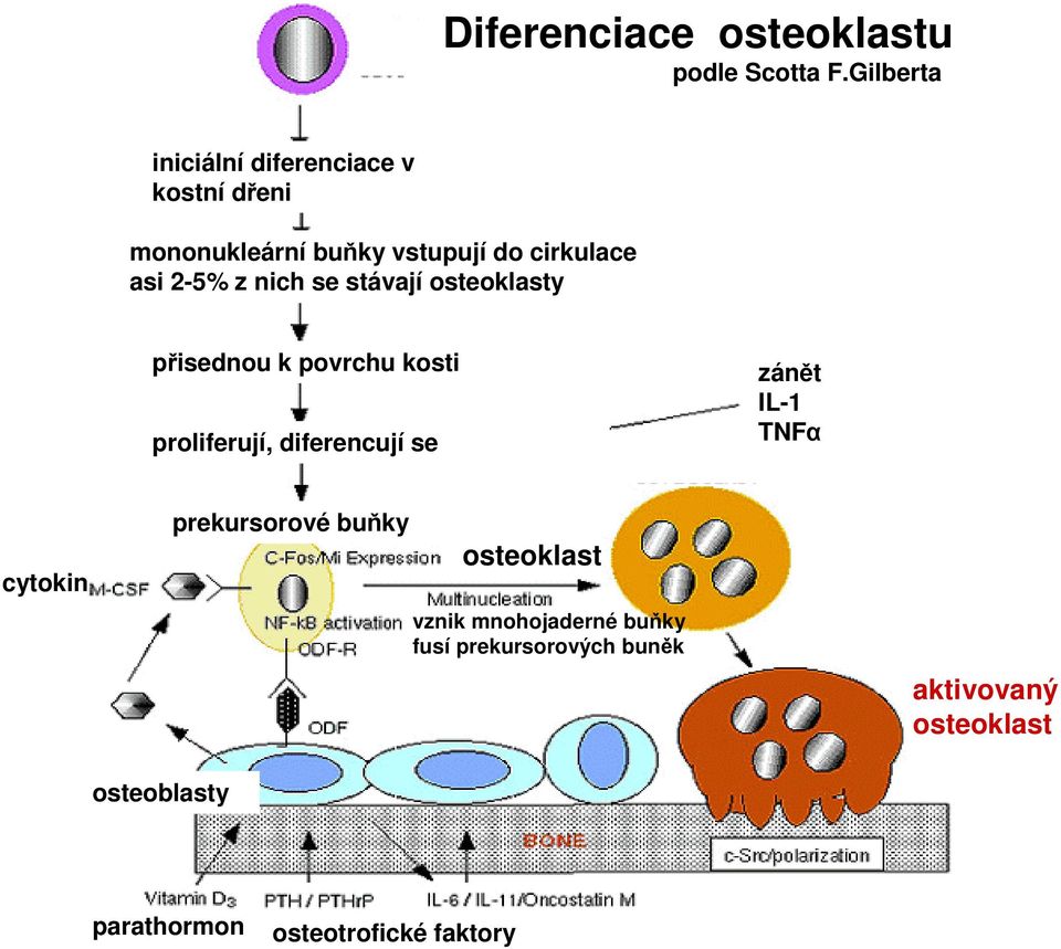 z nich se stávají osteoklasty přisednou k povrchu kosti proliferují, diferencují se zánět IL-1