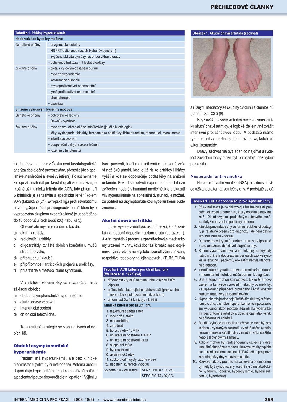 1 fosfát aldolázy Získané příčiny dieta s vysokým obsahem purinů hypertriglyceridemie konzumace alkoholu myeloproliferativní onemocnění lymfoproliferativní onemocnění chemoterapie psoriáza Snížené
