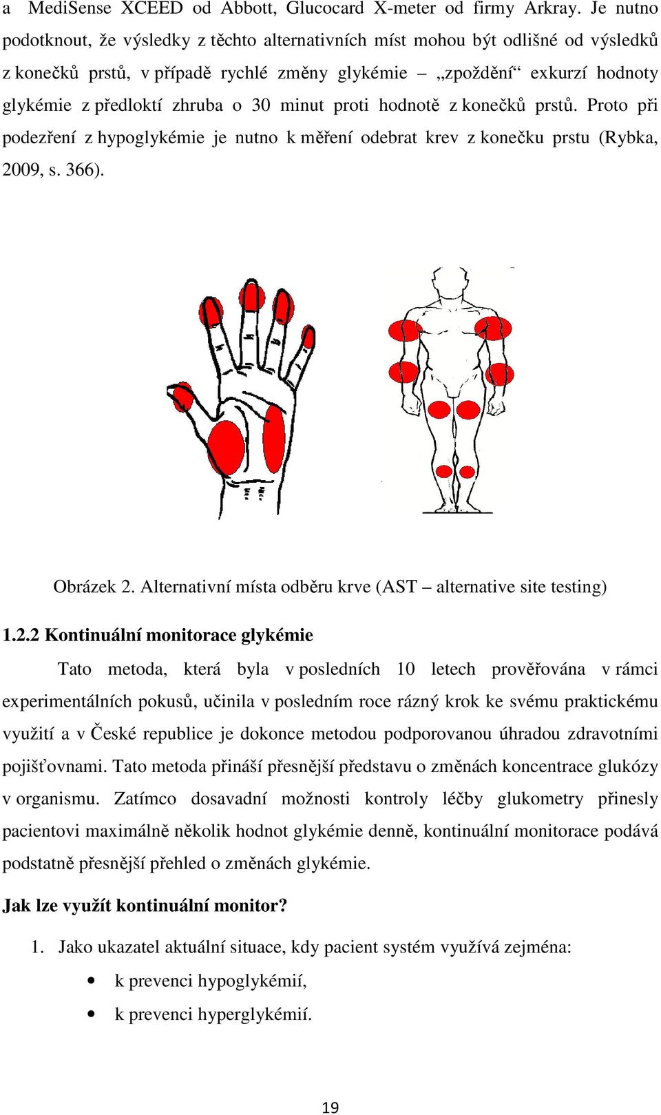 minut proti hodnotě z konečků prstů. Proto při podezření z hypoglykémie je nutno k měření odebrat krev z konečku prstu (Rybka, 2009, s. 366). Obrázek 2.