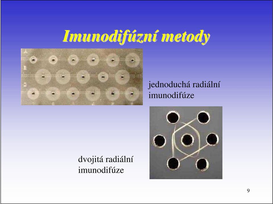 imunodifúze dvojitá