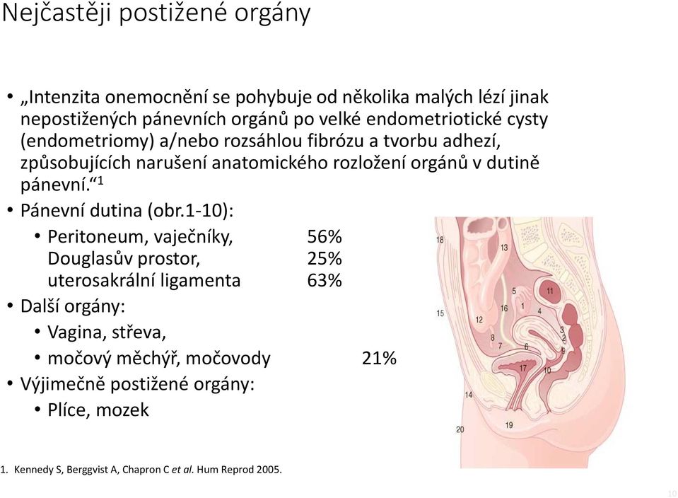 dutině pánevní. 1 Pánevní dutina (obr.