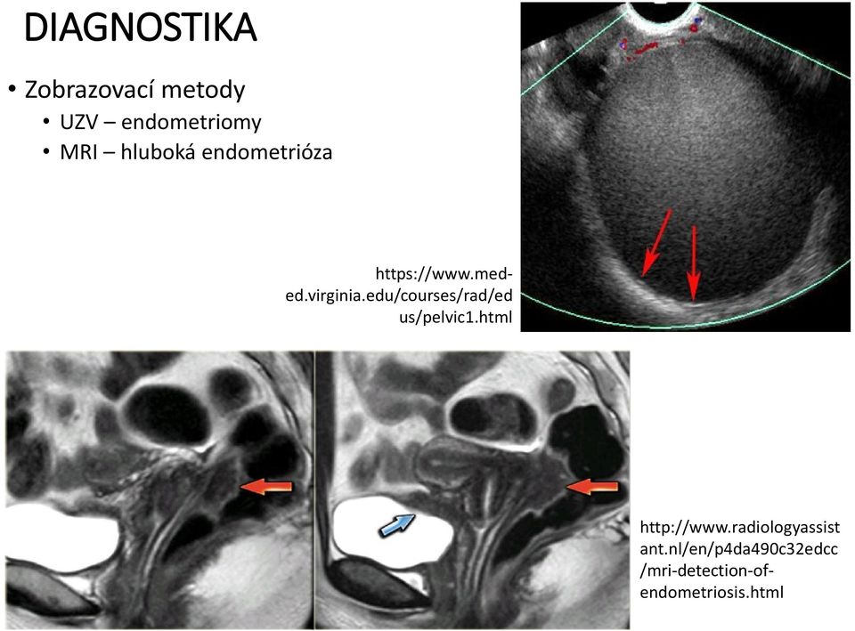 edu/courses/rad/ed us/pelvic1.html http://www.