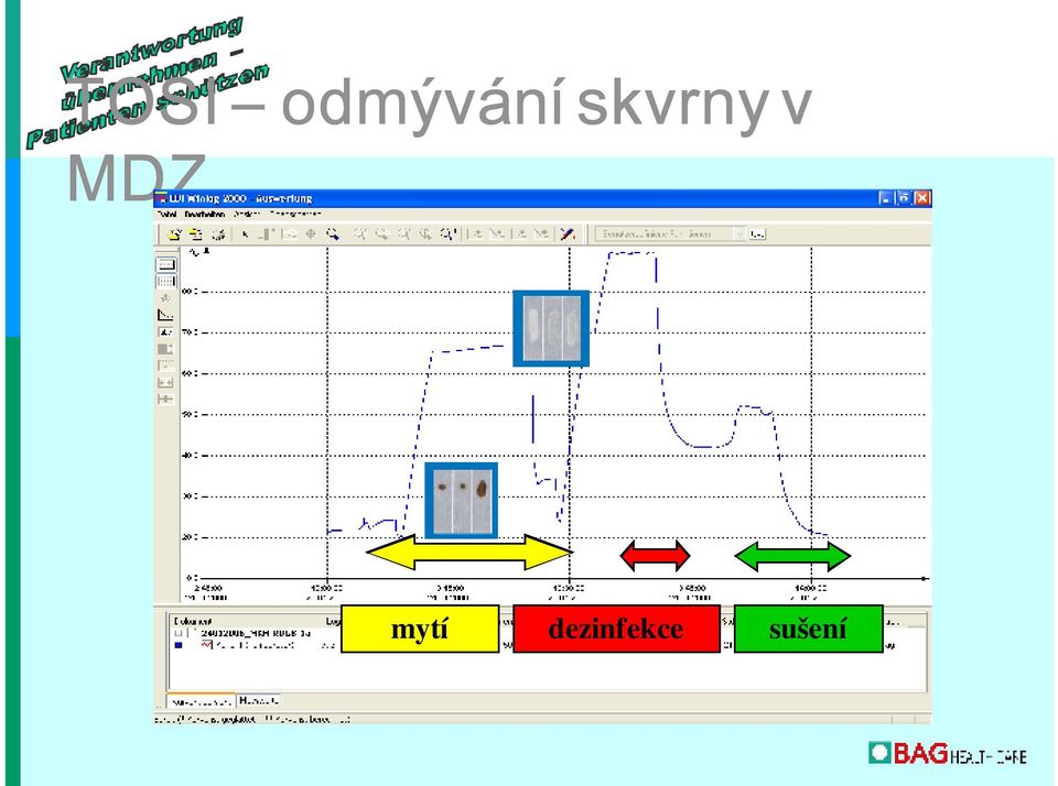 skvrny v MDZ