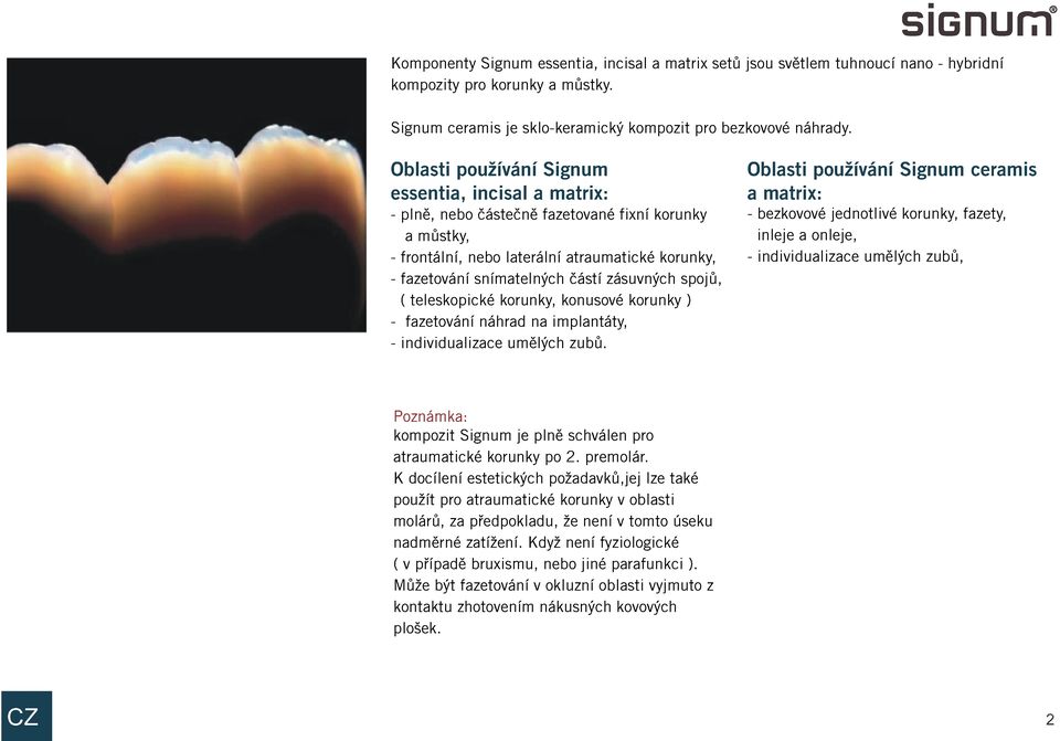 zásuvných spojù, ( teleskopické korunky, konusové korunky ) - fazetování náhrad na implantáty, - individualizace umìlých zubù.