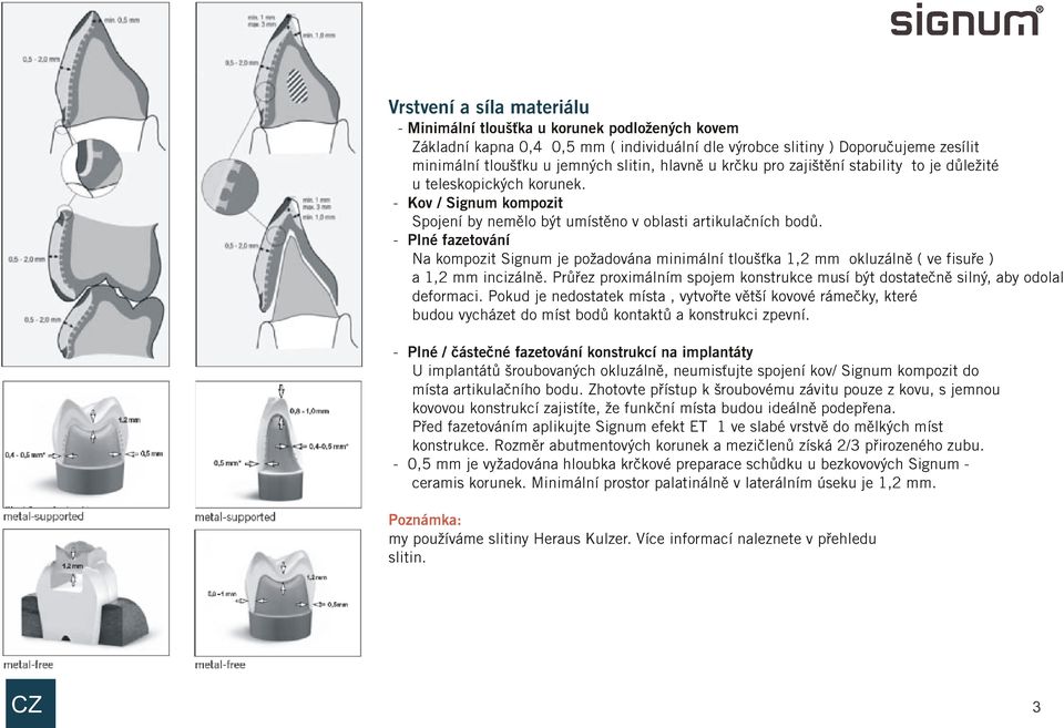 - Plné fazetování Na kompozit Signum je požadována minimální tlouš ka 1,2 mm okluzálnì ( ve fisuøe ) a 1,2 mm incizálnì.