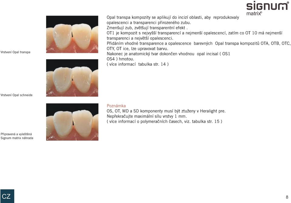 Pøidáním vhodné transparence a opalescence barevných Opal transpa kompozitù OTA, OTB, OTC, OTY, OT ice, lze upravovat barvu.