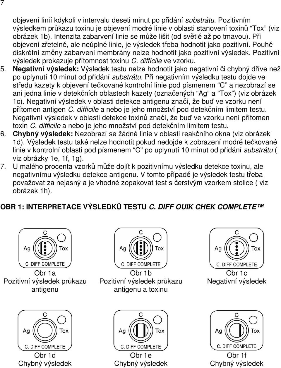 Pouhé diskrétní změny zabarvení membrány nelze hodnotit jako pozitivní výsledek. Pozitivní výsledek prokazuje přítomnost toxinu C. difficile ve vzorku. 5.