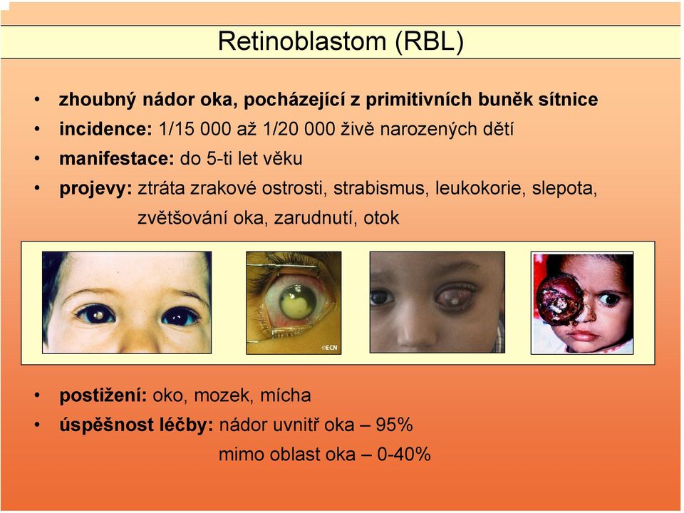 projevy: ztráta zrakové ostrosti, strabismus, leukokorie, slepota, zvětšování oka,