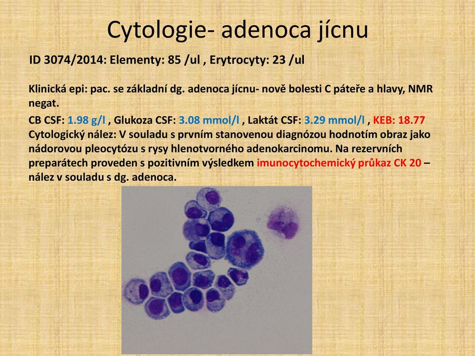 29 mmol/l, KEB: 18.