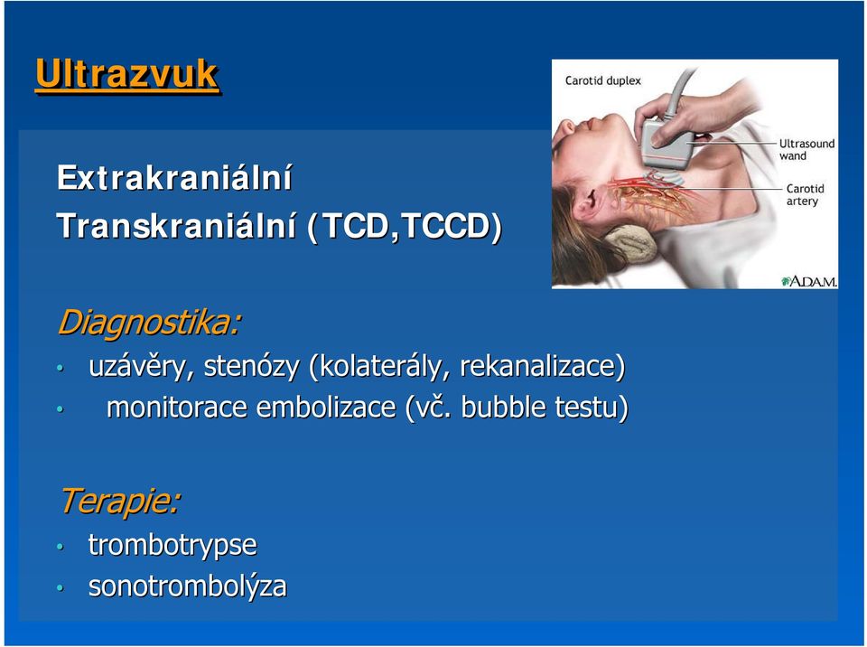 (kolaterály, ly, rekanalizace) monitorace