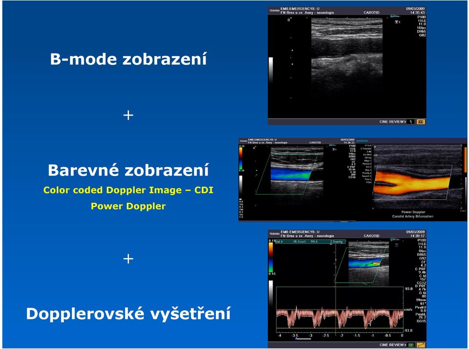 Doppler Image CDI Power