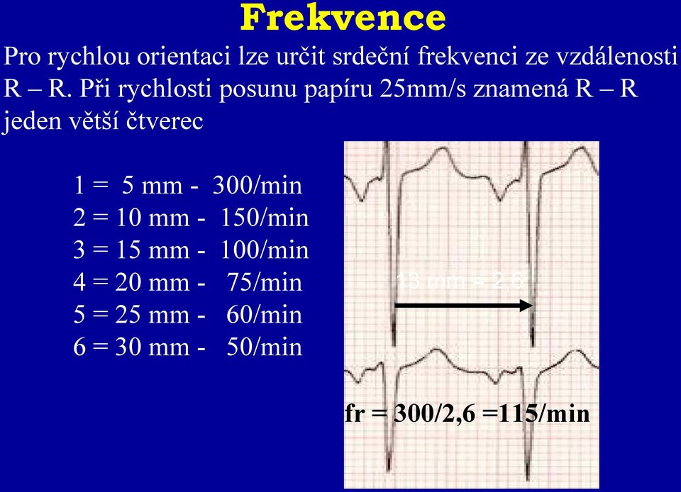 Při rychlosti posunu papíru 25mm/s znamená R R jeden větší čtverec 1 = 5