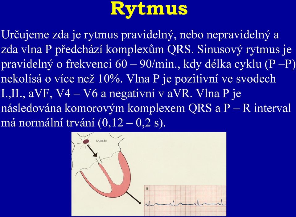 , kdy délka cyklu (P P) nekolísá o více než 10%. Vlna P je pozitivní ve svodech I.,II.