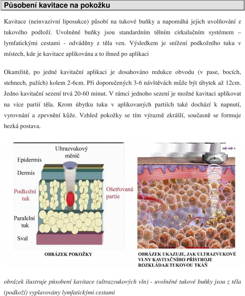 Výsledkem je snížení podkožního tuku v místech, kde je kavitace aplikována a to ihned po aplikaci Okamžitě, po jedné kavitační aplikaci je dosahováno redukce obvodu (v pase, bocích, stehnech, pažích)