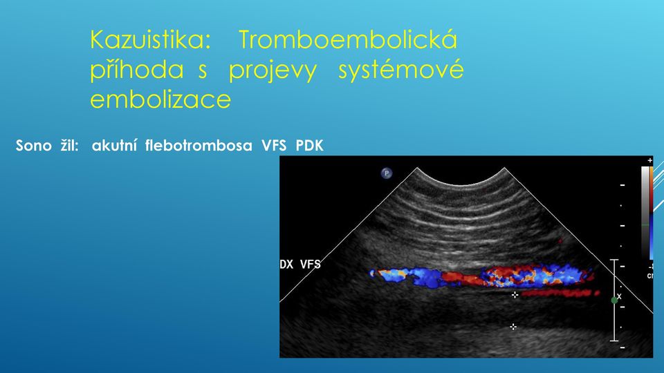 projevy systémové