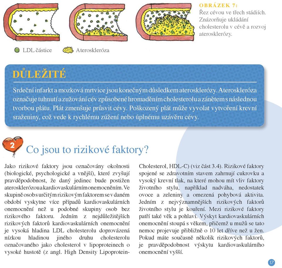 Ateroskleróza označuje tuhnutí a zužování cév způsobené hromaděním cholesterolu a zánětem s následnou tvorbou plátu. Plát zmenšuje průsvit cévy.