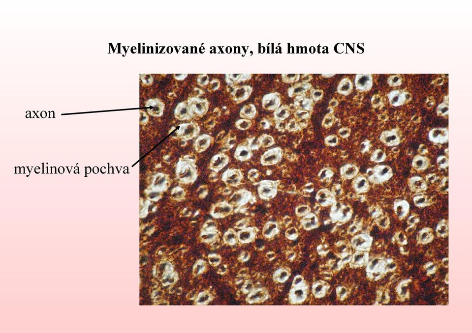 hmota CNS axon