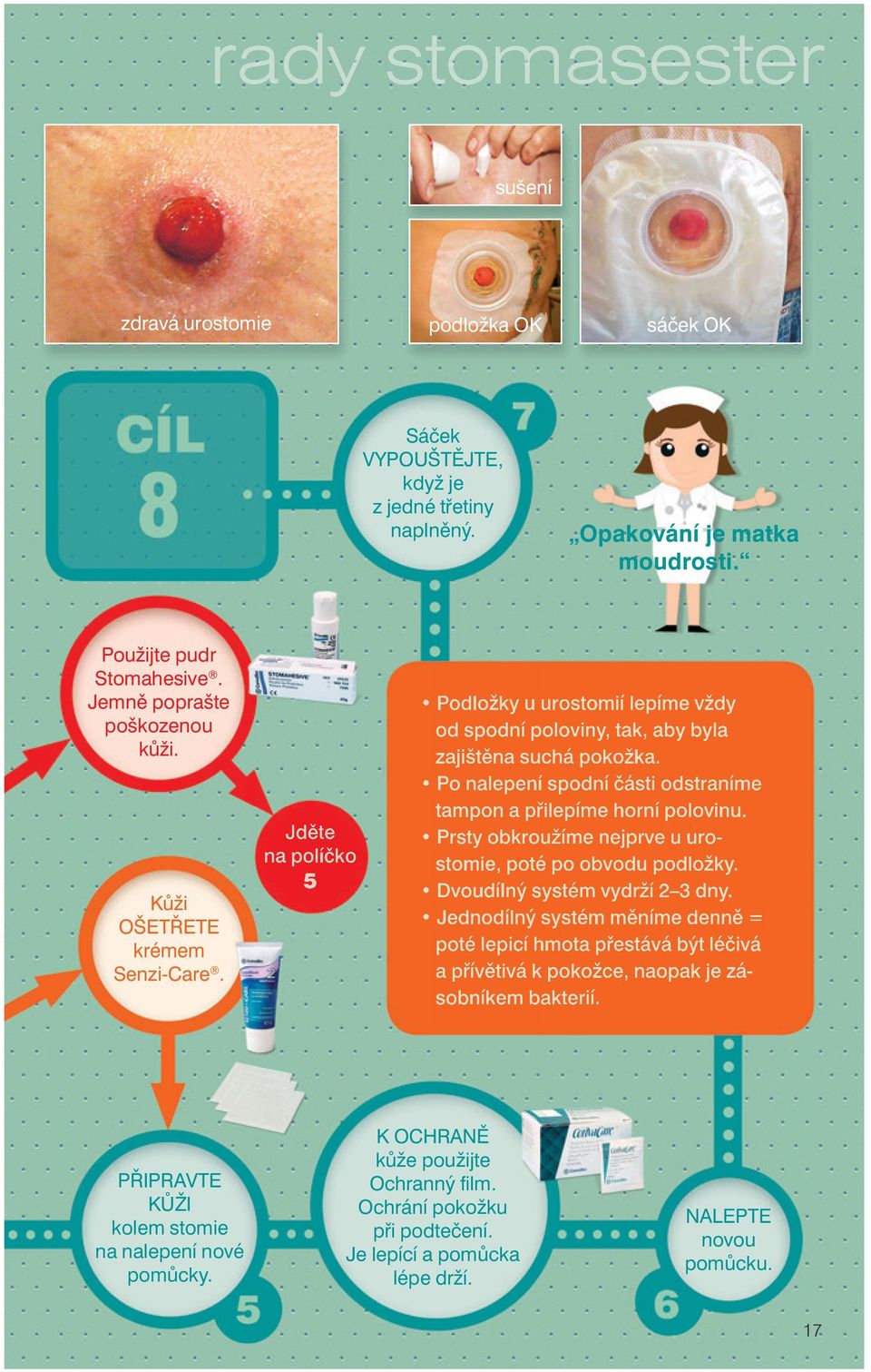 Po nalepení spodní části odstraníme tampon a přilepíme horní polovinu. Prsty obkroužíme nejprve u urostomie, poté po obvodu podložky. Dvoudílný systém vydrží 2 3 dny.