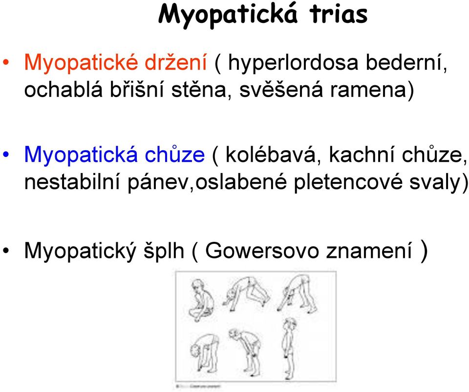 Myopatická chůze ( kolébavá, kachní chůze, nestabilní