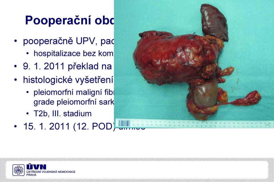 2011 překlad na JIP Chirurgické kliniky histologické vyšetření: