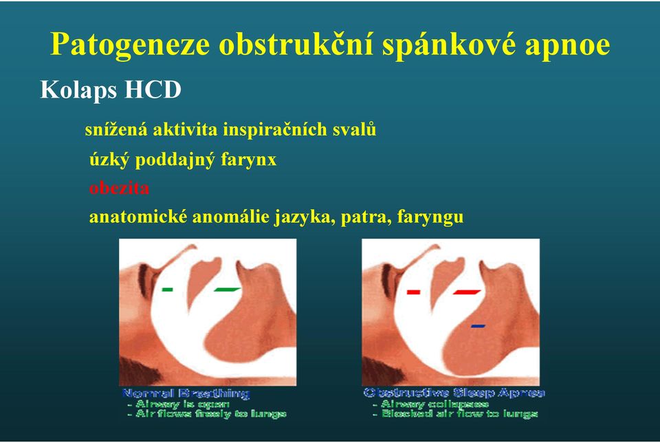 inspiračních svalů úzký poddajný