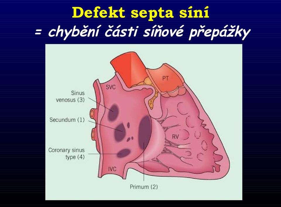 chybění