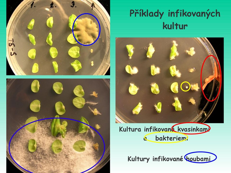 infikovaná kvasinkami a