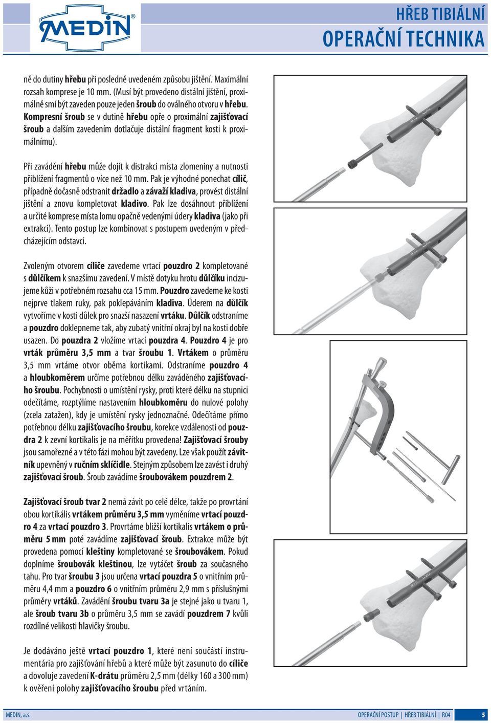 Kompresní šroub se v dutině hřebu opře o proximální zajišťovací šroub a dalším zavedením dotlačuje distální fragment kosti k proximálnímu).