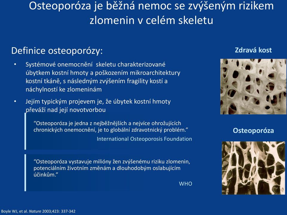 novotvorbou Osteoporóza je jedna z nejběžnějších a nejvíce ohrožujících chronických onemocnění, je to globální zdravotnický problém.