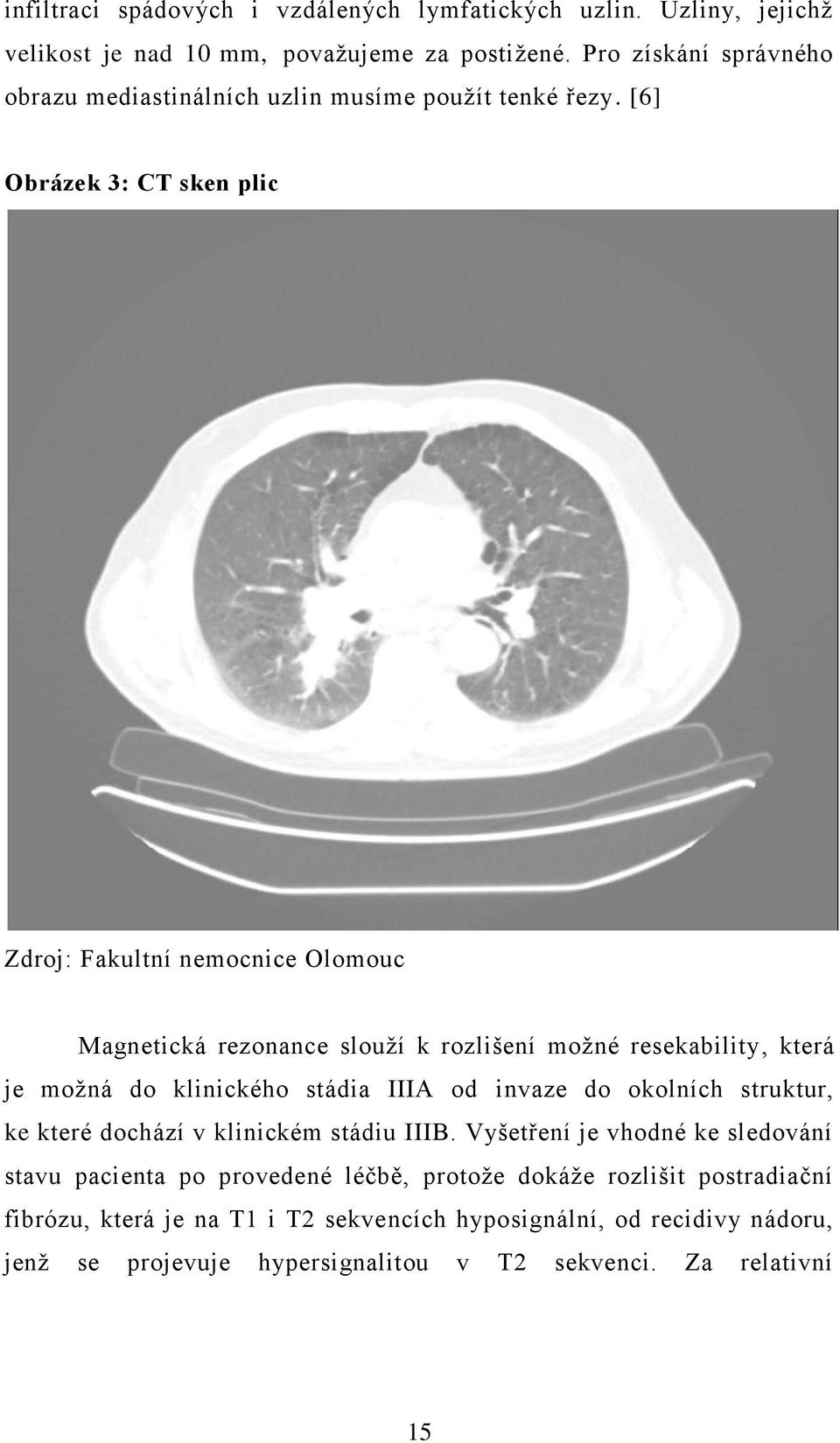 [6] Obrázek 3: CT sken plic Zdroj: Fakultní nemocnice Olomouc Magnetická rezonance slouží k rozlišení možné resekability, která je možná do klinického stádia IIIA od
