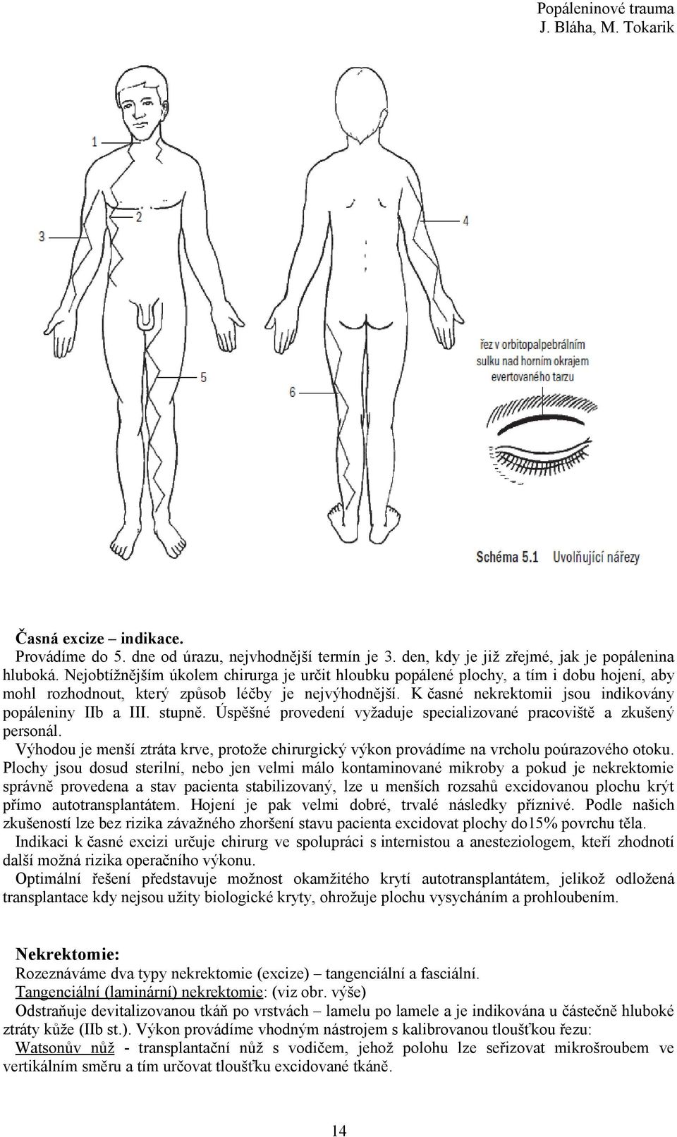 K časné nekrektomii jsou indikovány popáleniny IIb a III. stupně. Úspěšné provedení vyžaduje specializované pracoviště a zkušený personál.