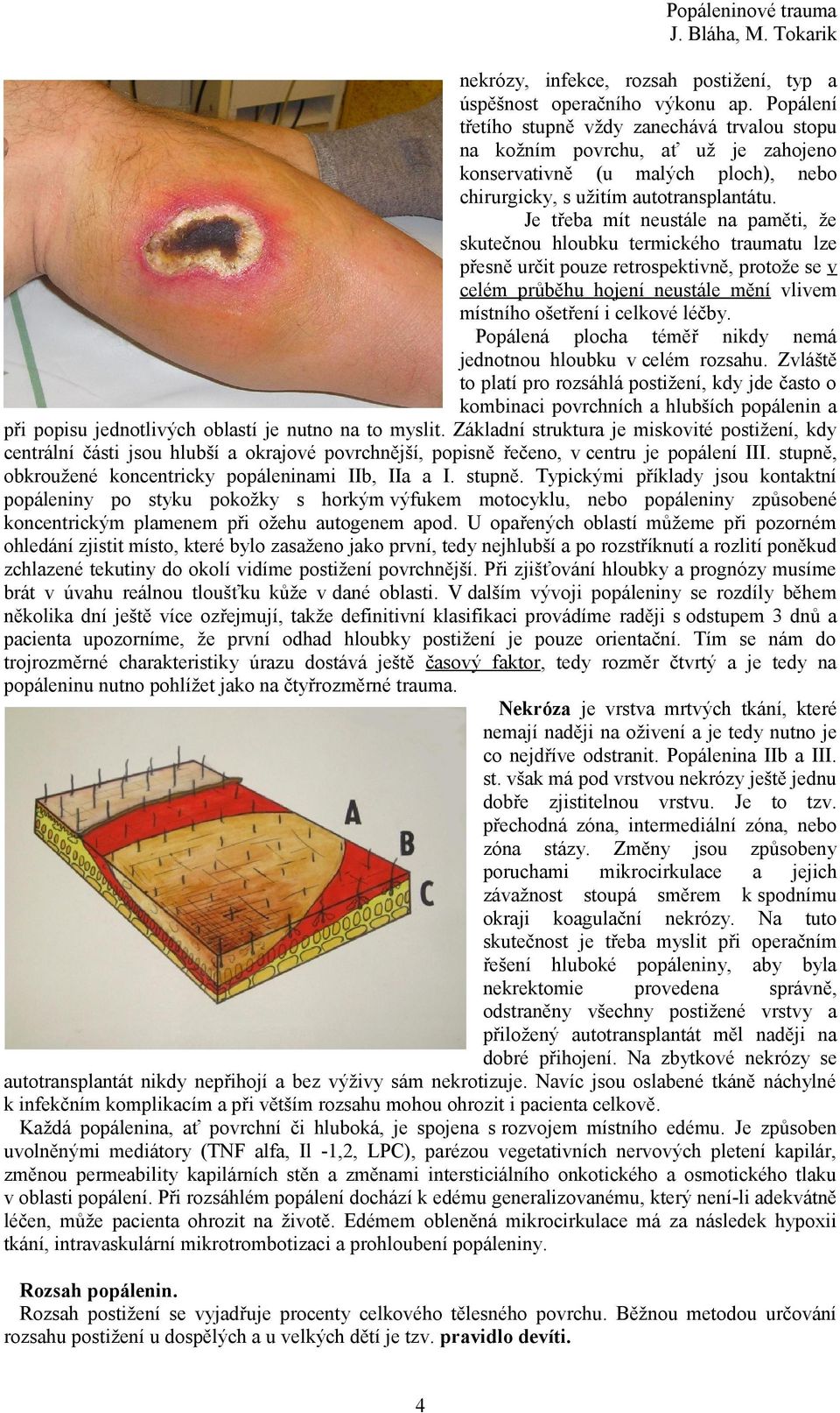 Je třeba mít neustále na paměti, že skutečnou hloubku termického traumatu lze přesně určit pouze retrospektivně, protože se v celém průběhu hojení neustále mění vlivem místního ošetření i celkové