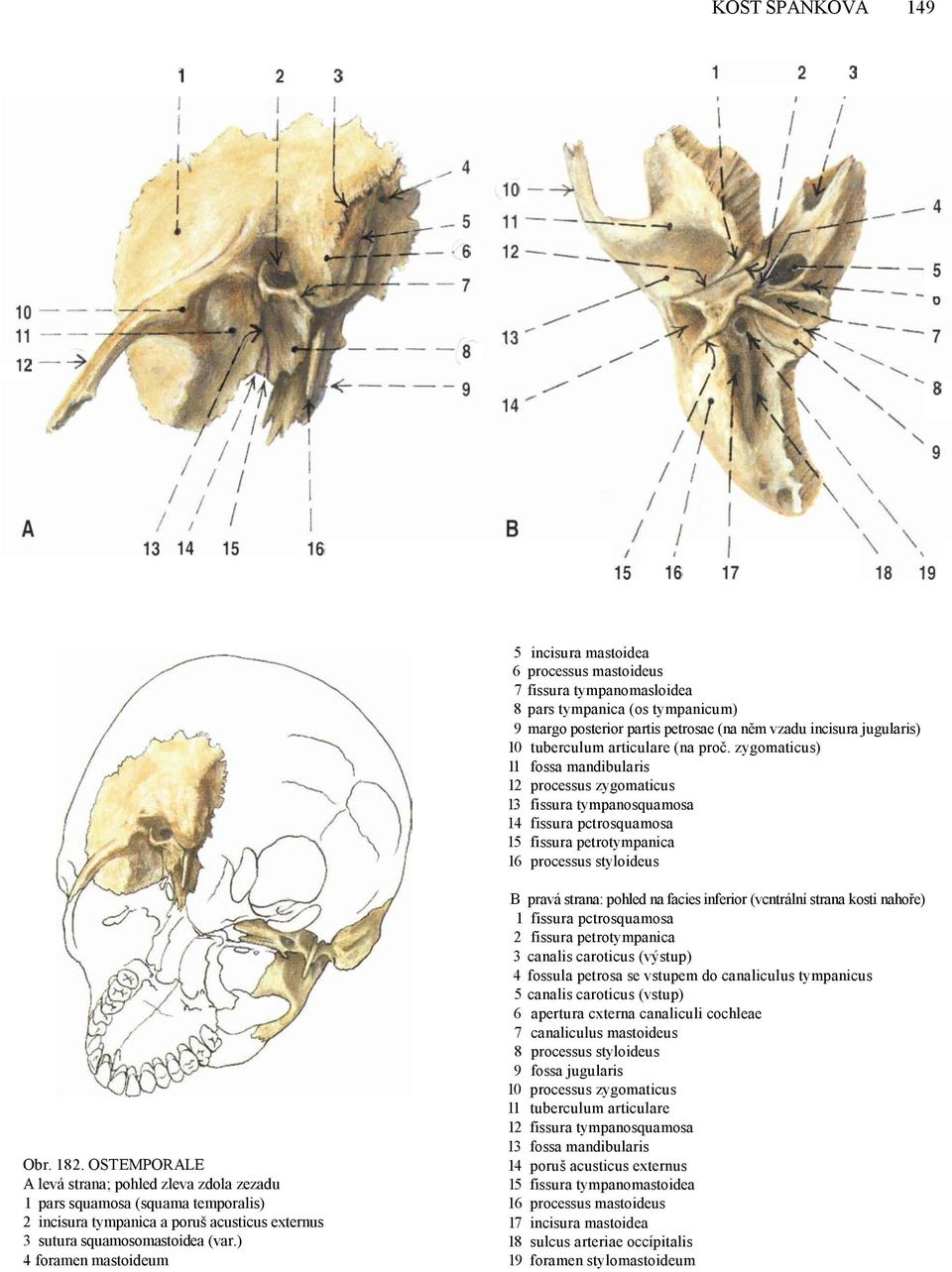 182. OSTEMPORALE A levá strana; pohled zleva zdola zezadu 1 pars squamosa (squama temporalis) 2 incisura tympanica a poruš acusticus externus 3 sutura squamosomastoidea (var.