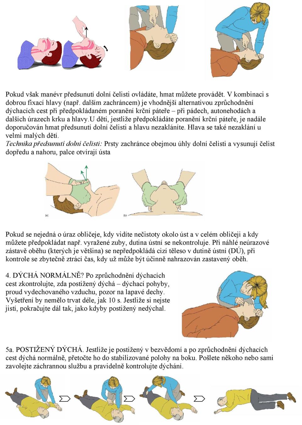 u dětí, jestliže předpokládáte poranění krční páteře, je nadále doporučován hmat předsunutí dolní čelisti a hlavu nezakláníte. Hlava se také nezaklání u velmi malých dětí.