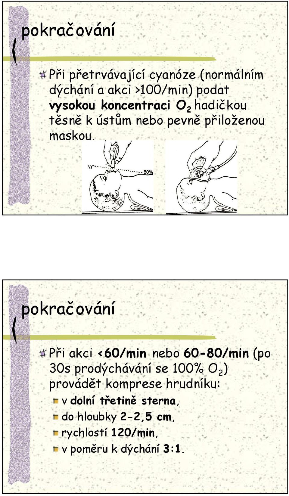 pokračování Při akci <60/min nebo 60-80/min (po 30s prodýchávání se 100% O 2 ) provádět