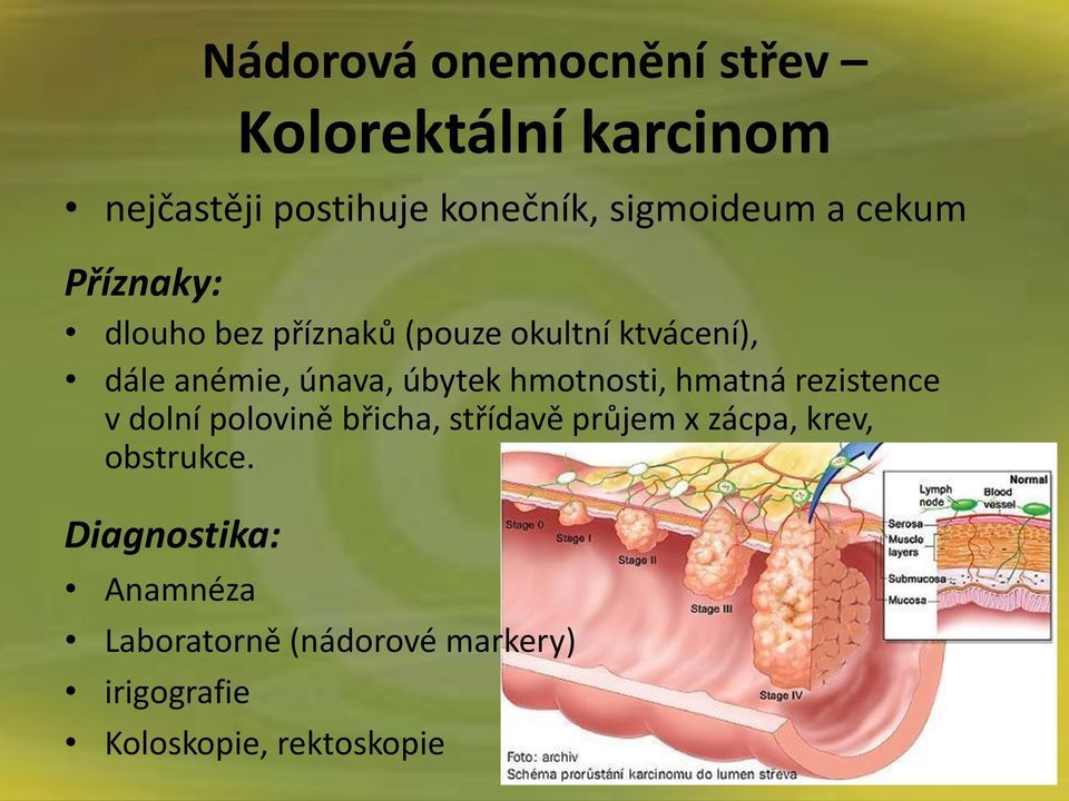 hmotnosti, hmatná rezistence v dolní polovině břicha, střídavě průjem x zácpa, krev,