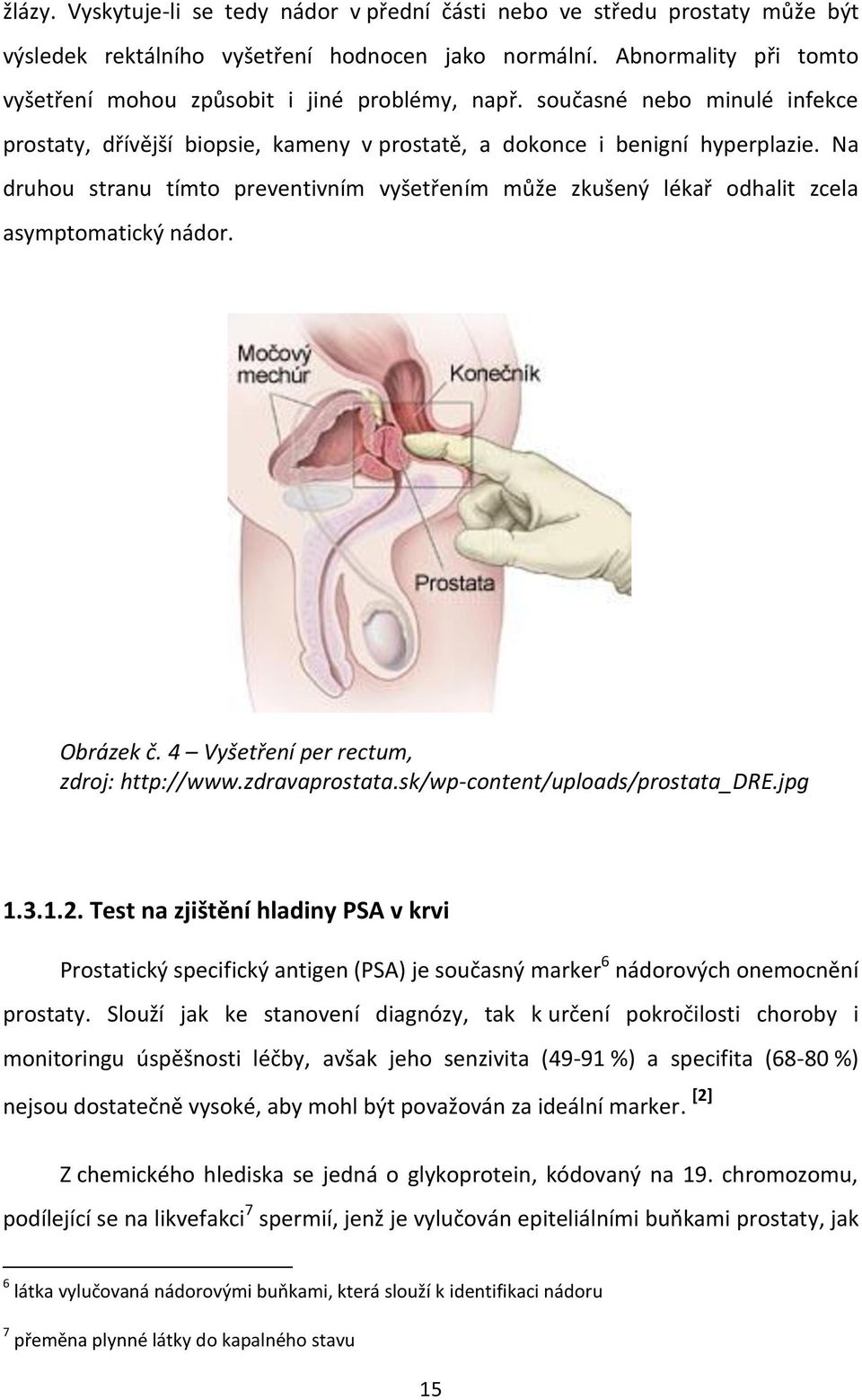 Na druhou stranu tímto preventivním vyšetřením může zkušený lékař odhalit zcela asymptomatický nádor. Obrázek č. 4 Vyšetření per rectum, zdroj: http://www.zdravaprostata.