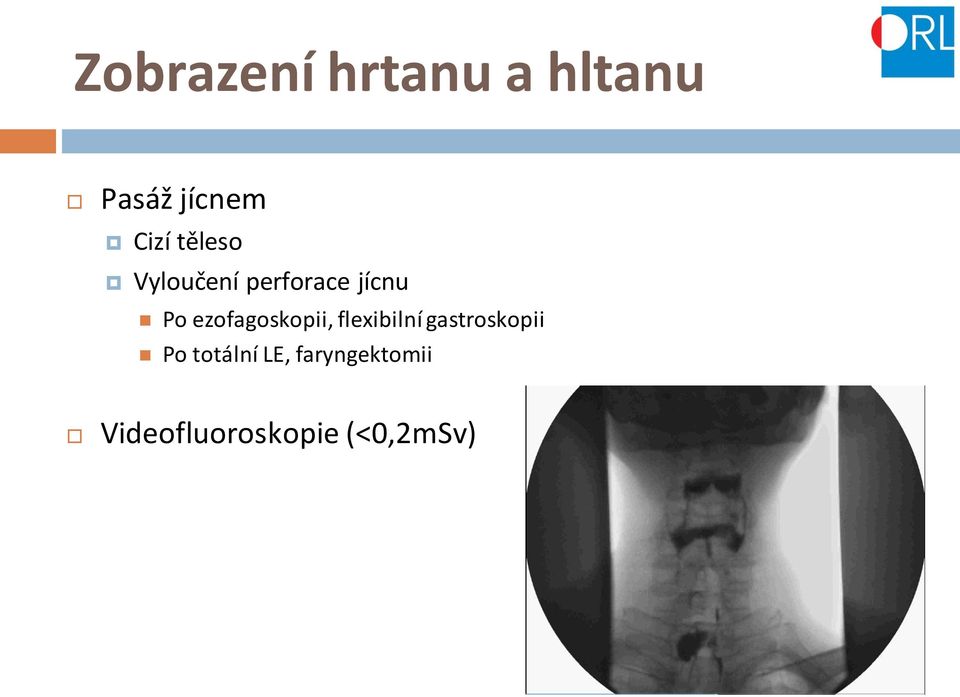 ezofagoskopii, flexibilní gastroskopii Po