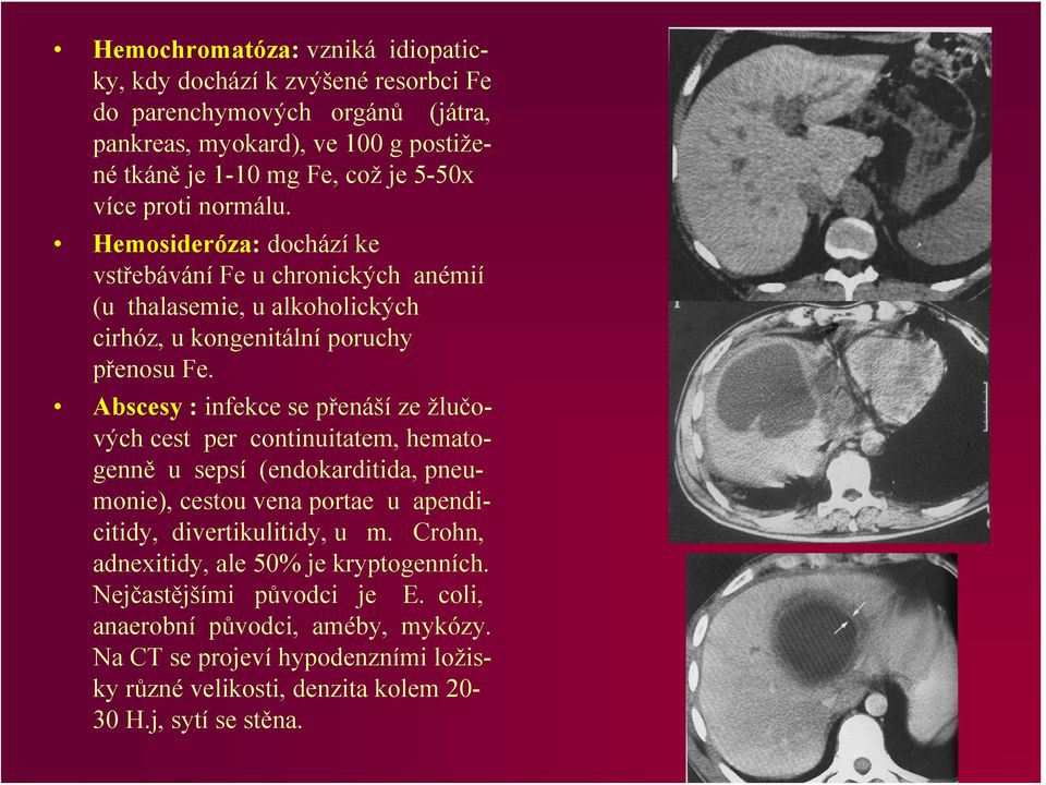 Abscesy : infekce se přenáší ze žlučových cest per continuitatem, hematogenně u sepsí (endokarditida, pneumonie), cestou vena portae u apendicitidy, divertikulitidy, u m.