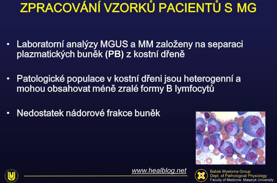 Patologické populace v kostní dřeni jsou heterogenní a mohou